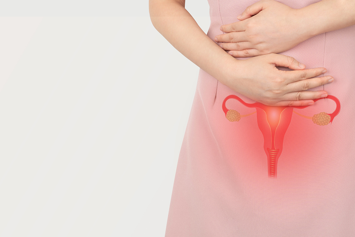 Woman suffering from pelvic pain with uterus and ovaries anatomy. Cause of pain inclued dysmenorrhea, edometriosis, PCOS, PMS, STDs, gynecologic cancer. Reproductive system and woman health problems.