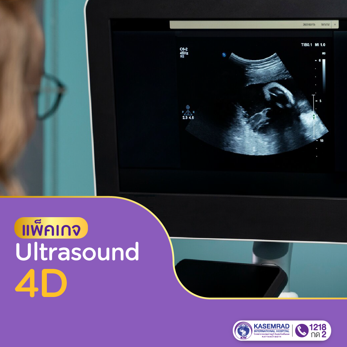 แพ็กเกจ ตรวจดูพัฒนาการของลูกน้อยภายในครรภ์ Ultrasound 4D