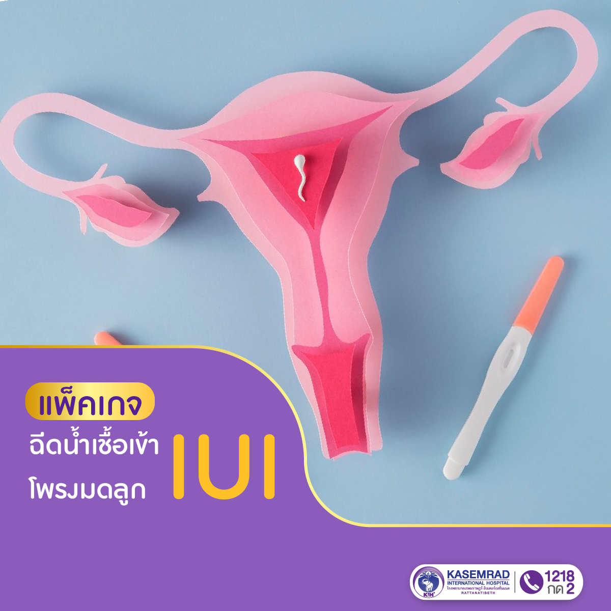 แพ็กเกจ IUI ฉีดน้ำเชื้อเข้าโพรงมดลูก