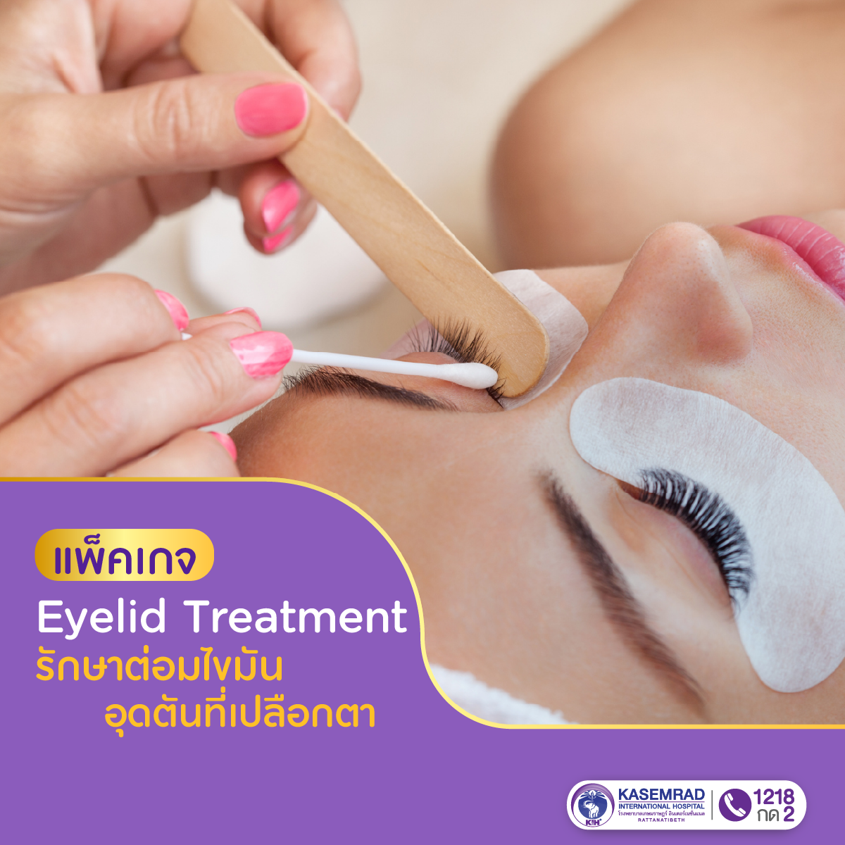 แพ็กเกจ Eyelid Treatment รักษาต่อมไขมันอุดตันที่เปลือกตา