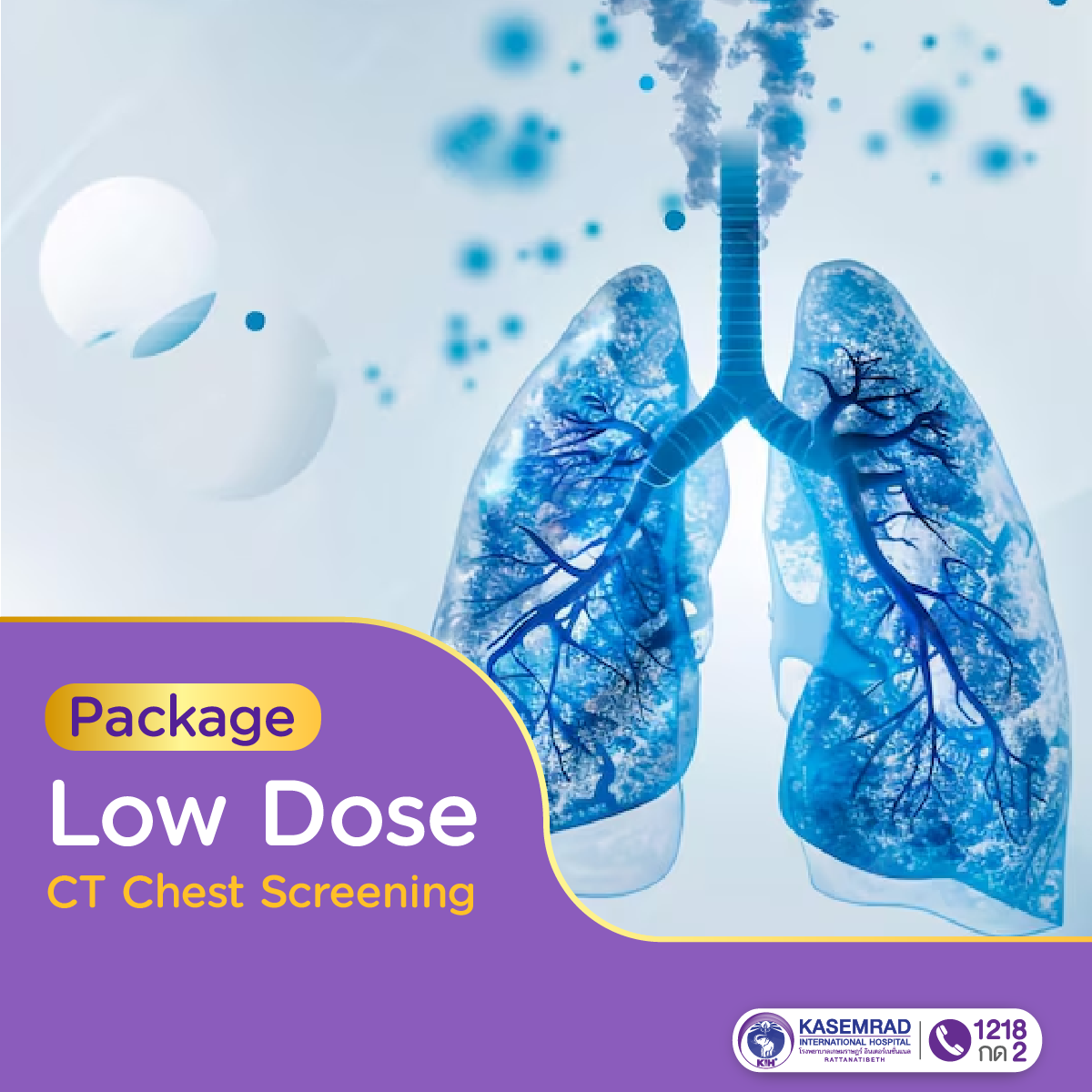 Low-Dose CT Chest Screening Package