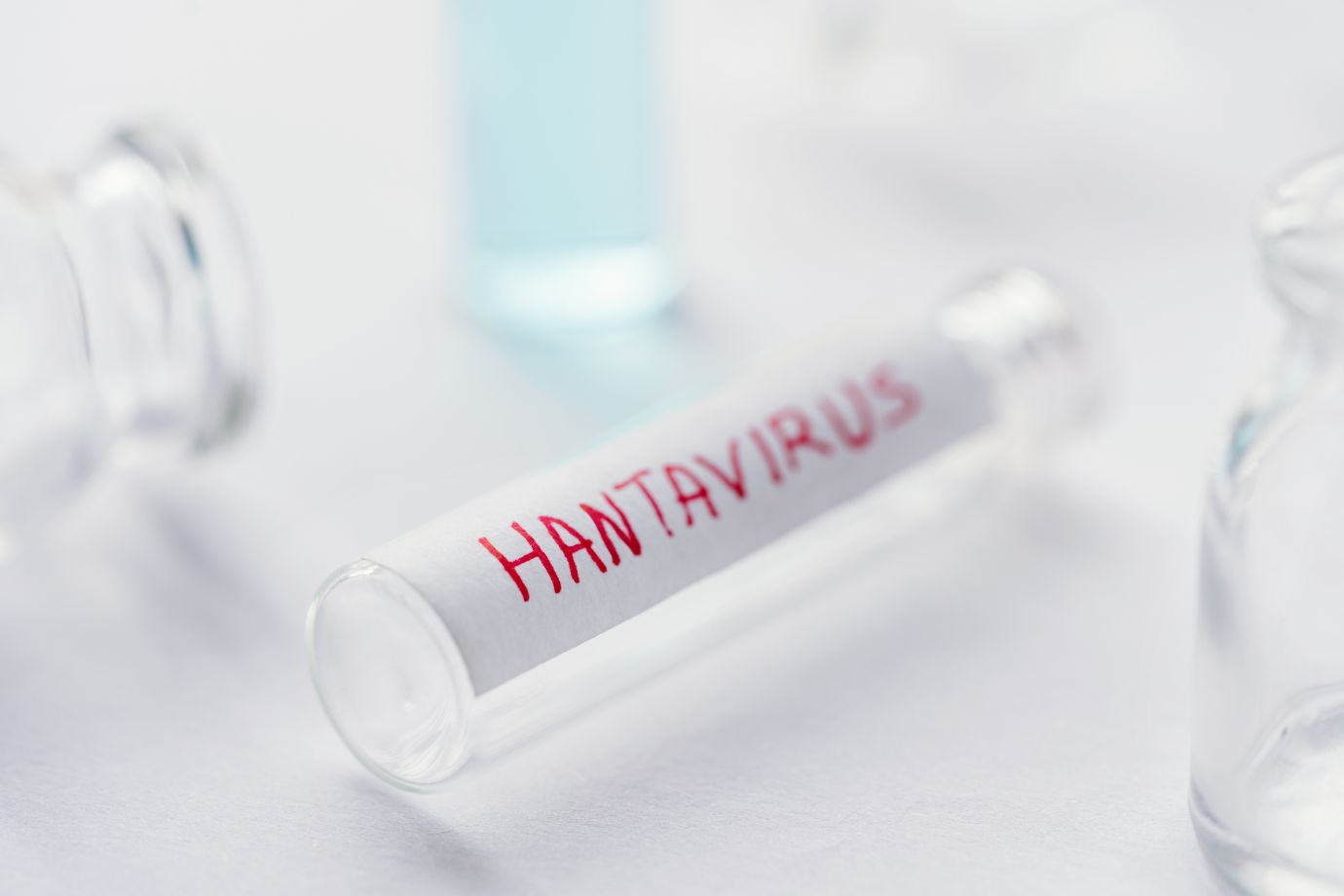 รู้จัก “ไวรัสฮันตา” (Hantavirus) โรคจากหนูที่ทั่วโลกกำลังจับตา: อาการ การติดต่อ และวิธีป้องกัน